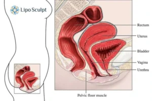 Treatment For A Leaky Bladder 2 How EM Chair treatment Harpenden can help Leaky bladder issues. Read more now!